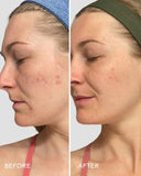 Three Ships - REFRESH Papaya + Salicylic Acid Cleanser